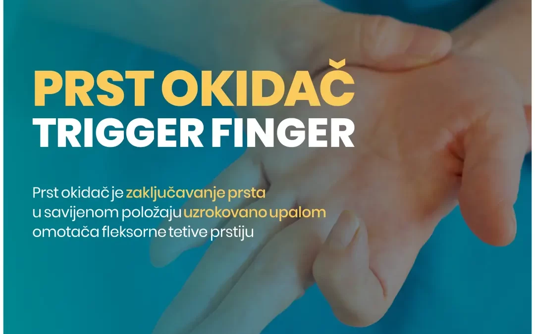 Prst okidac